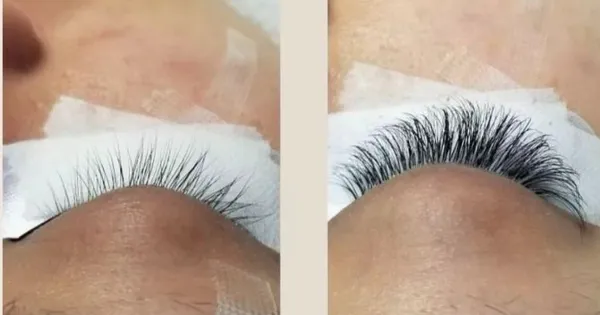 Before & After