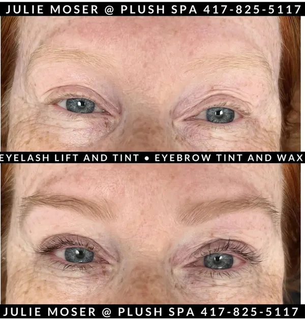 Before & After