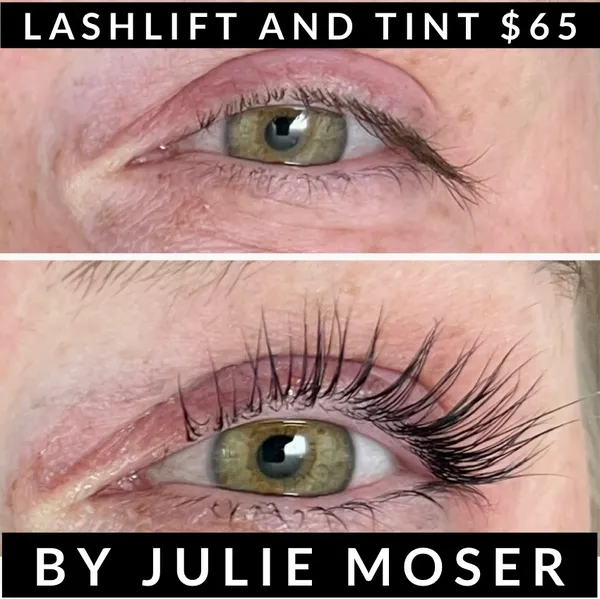 Before & After