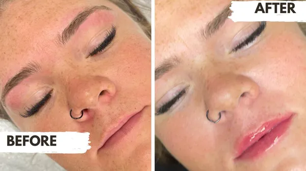Before & After